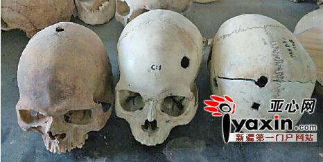 На выставке в Китае показали древние черепа со следами трепанации